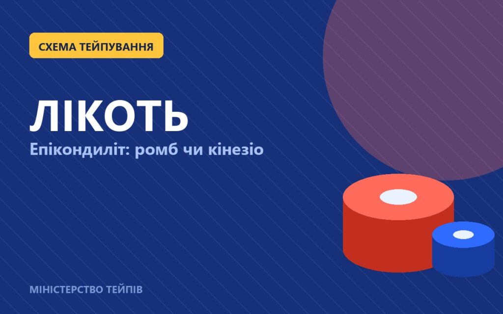 Тейпування ліктя при епікондиліті: жорсткий ромб чи кінезіо