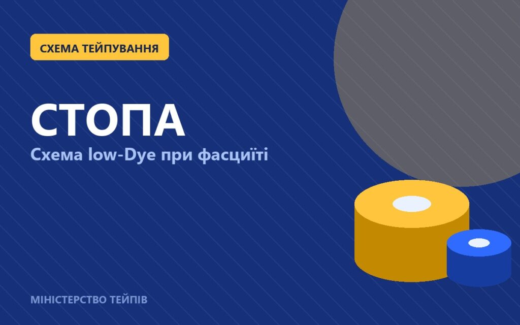 Тейпування стопи при підошовному фасциїті: схема low-Dye